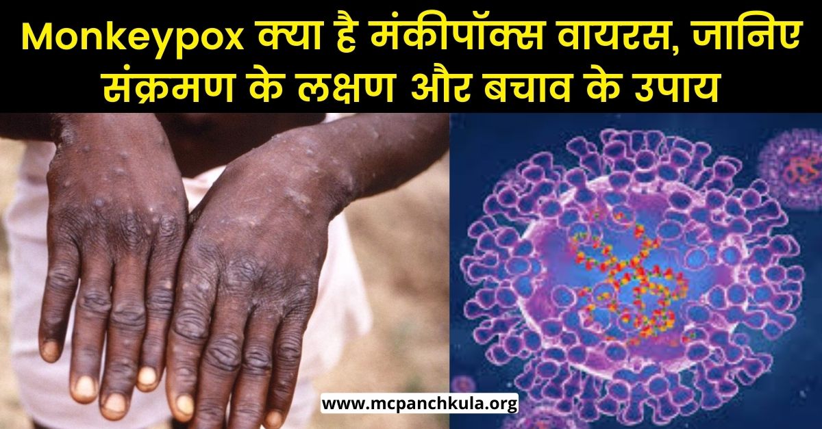 What-is-monkeypox-its-symptoms-and-preventive-measures