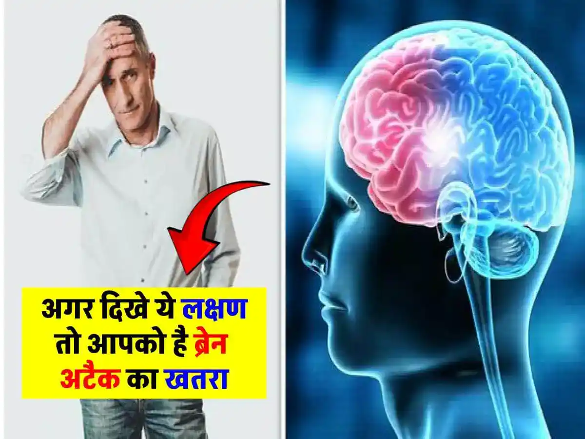 Signs of Brain Attack