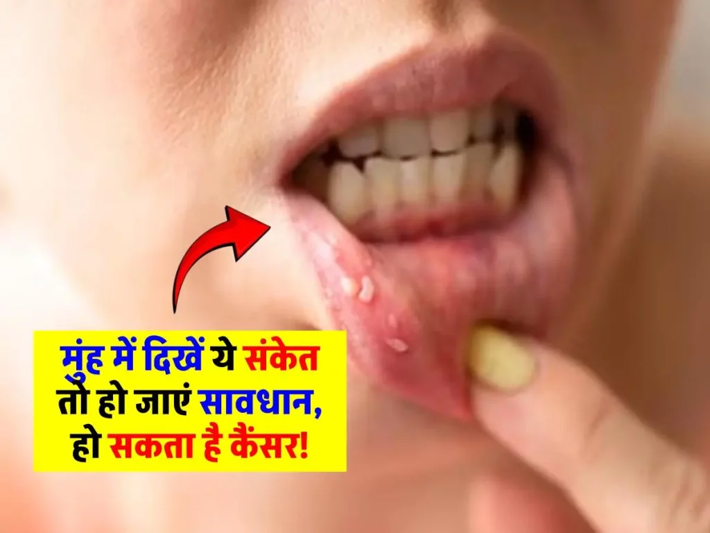 Symptoms of Mouth Cancer